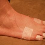 Paper Tape Can Prevent Blisters